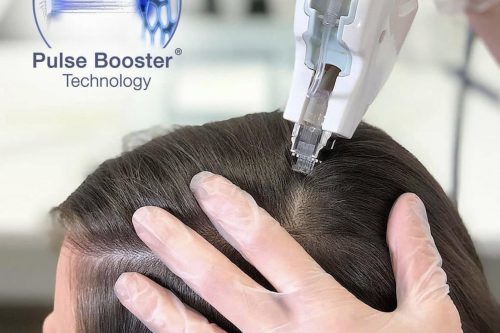 1BF9D254-0DA6-4DDE-97F5-6C6E26DC1193