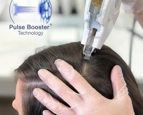 1BF9D254-0DA6-4DDE-97F5-6C6E26DC1193